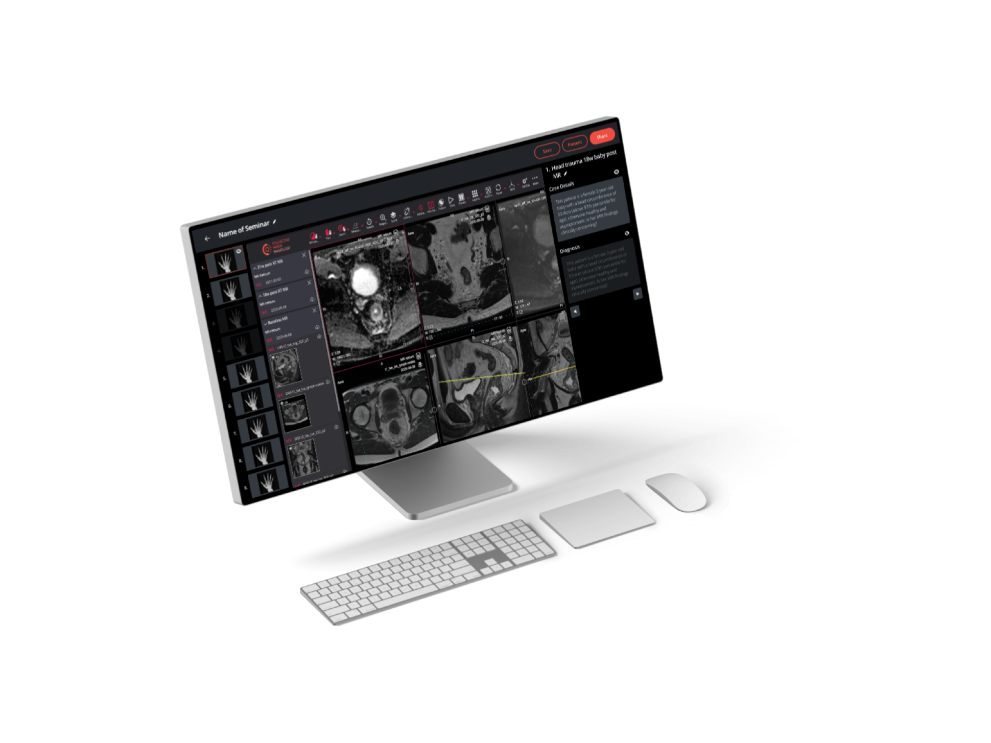 Education-Live Sessions-Monitor XDR