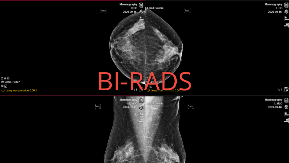 BI-RADS standard and medical imaging research BI-RADS standard and medical imaging research