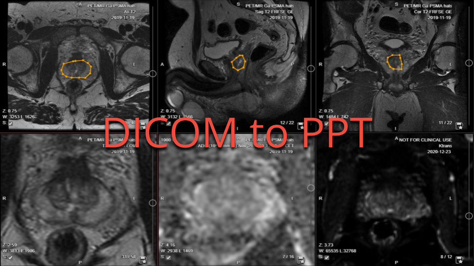 Collective Minds Radiology DICOM to PPT Collective Minds Radiology DICOM to PPT