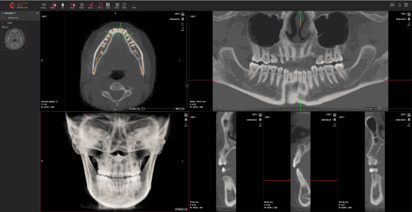 Ct Reference Guide Hounsfield Units (HU) Explained | CT Numbers & Density Guide