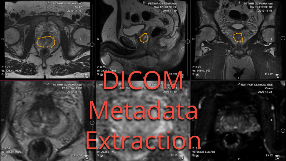 DICOM metadata extraction DICOM metadata extraction