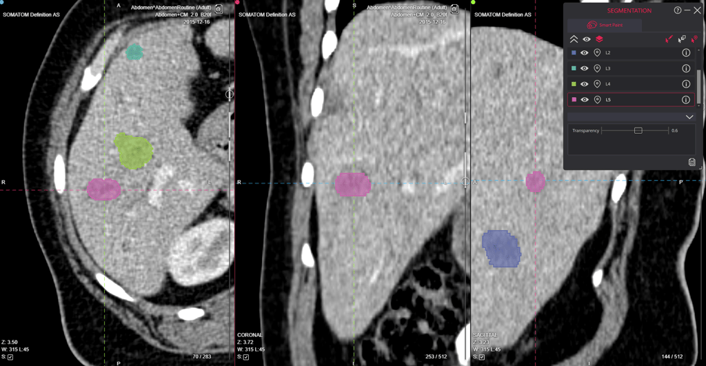 Medical Imaging Core Lab Segmentation Tools