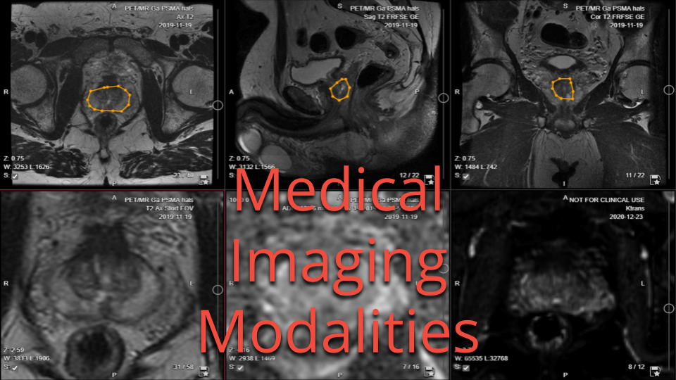 Medical Imaging Modalities Medical Imaging Modalities
