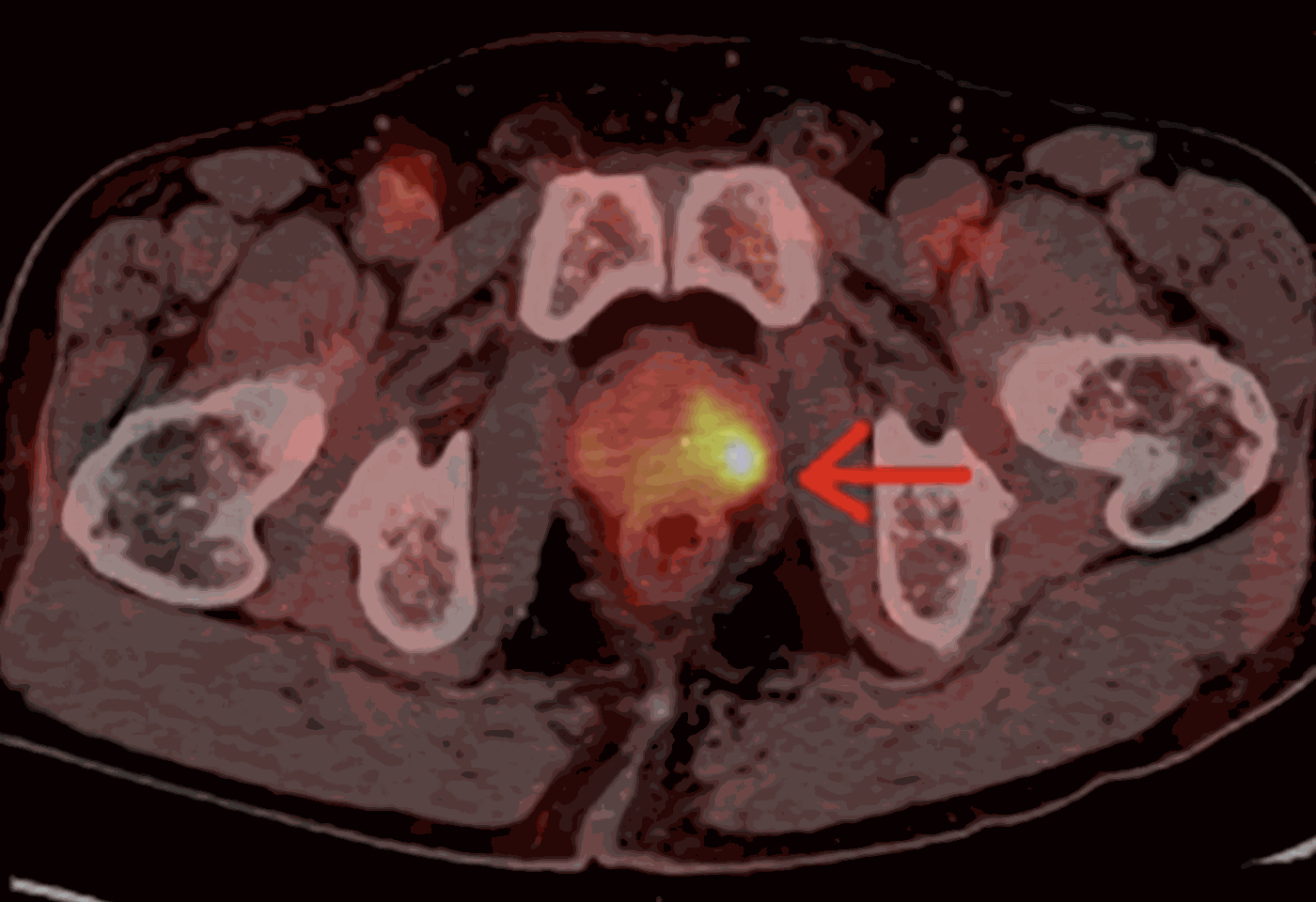 Cancer Imaging Explained | Key Diagnostic Tests & AI Advances