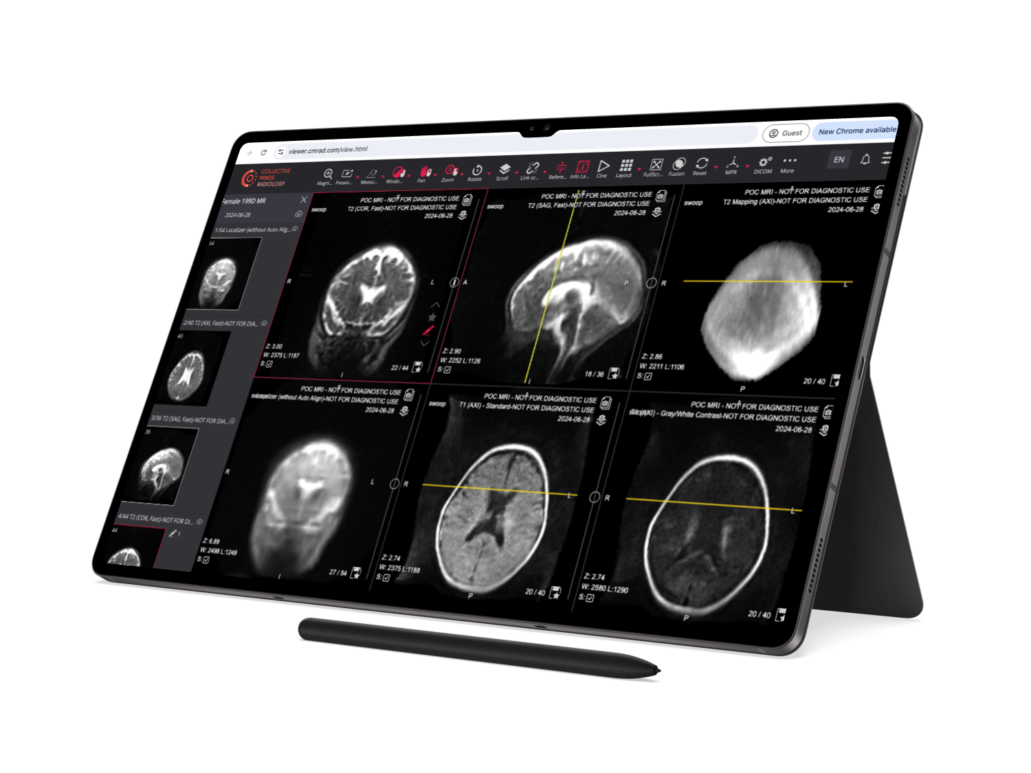 High-Field MRI Systems: How 3T and 7T Scanners Transform Modern Medical ...