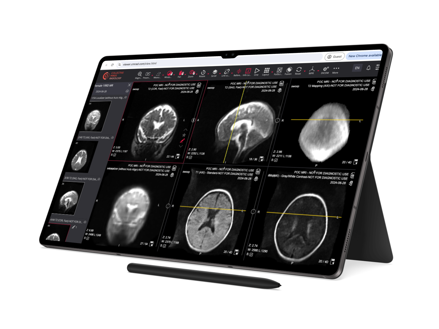 Education-DICOM Viewer-Galaxy Tab S8 Ultra Education-DICOM Viewer-Galaxy Tab S8 Ultra