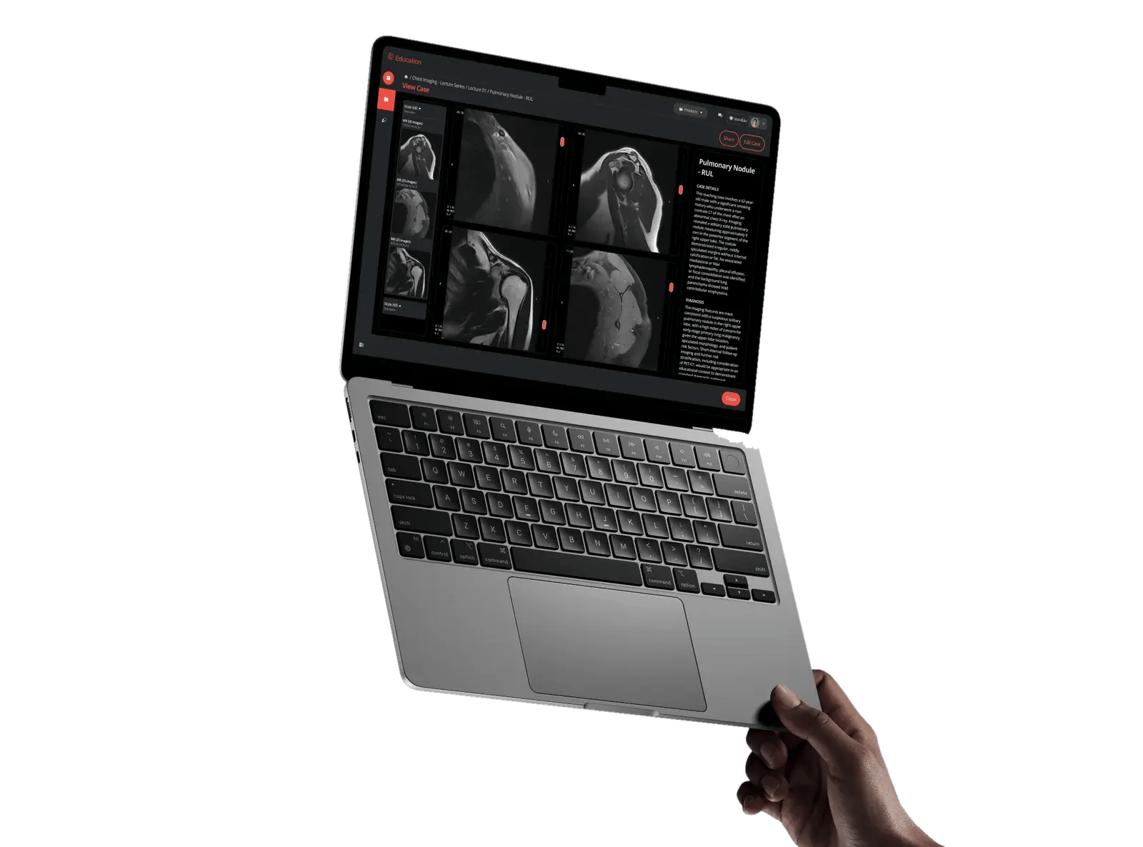 cm-laptop-mockup-4-transparent