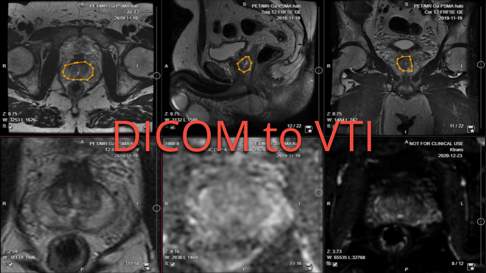 collective minds research segmentation DICOM to VTI collective minds research segmentation DICOM to VTI
