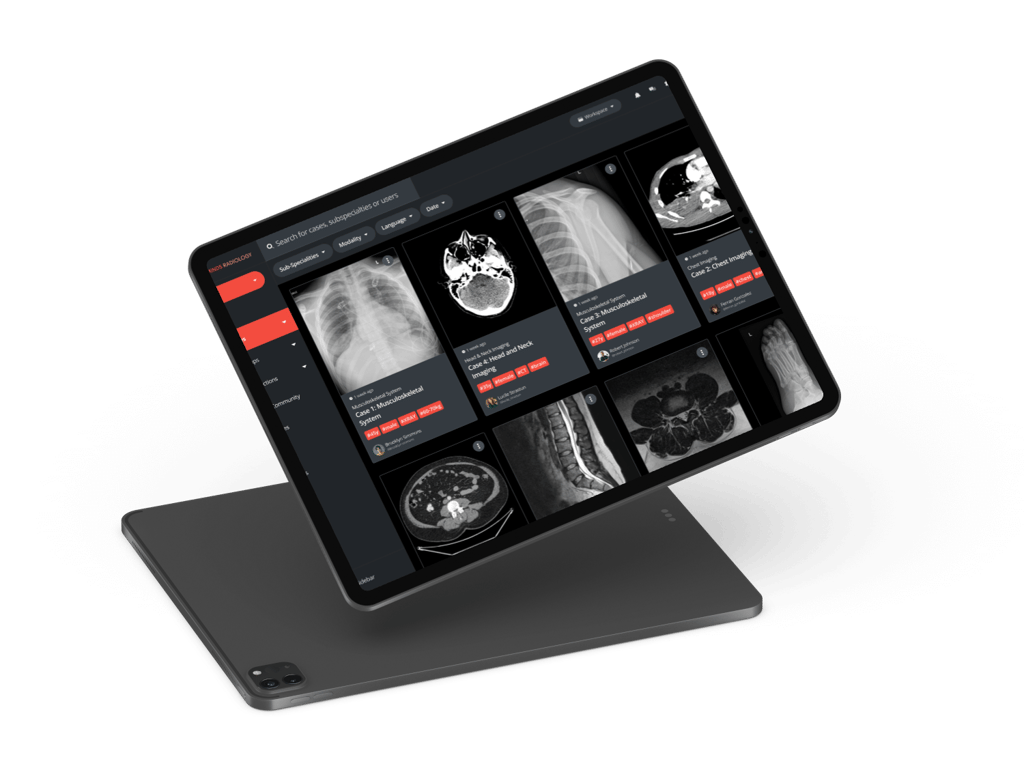 Human Factor Studies Medical Device Software